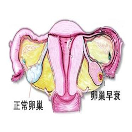 为什么会出现卵巢早衰