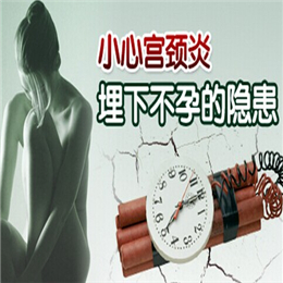 宫颈炎的症状